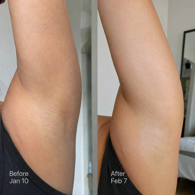 Michelle D. — My Skin is Totally Transformed | Zarnier Silk Body Oil review