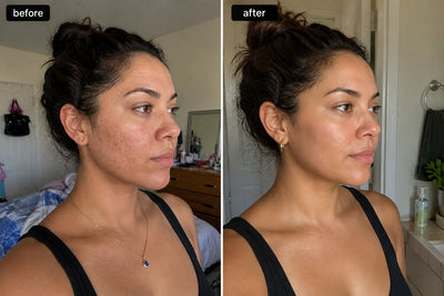 Alice R. — The Difference Is Undeniable | Zarnier Silk Body Oil review